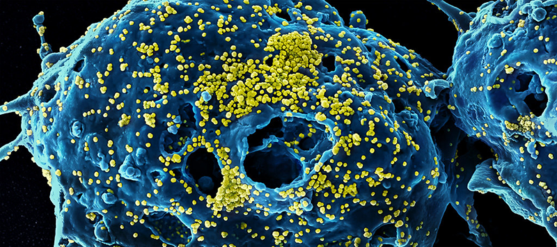 Virus image